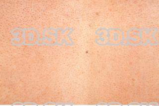 Skin texture of Alberto 0003